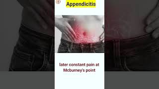 Appendix pain  appendicitis  shorts shortsfeed [upl. by Nitsud]