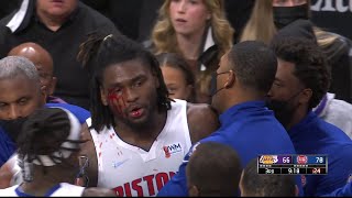 LeBron James Isaiah Stewart Ejections After Bloody Altercation Spark Mixed Reactions [upl. by Nirik496]