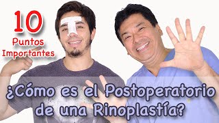 ¿Cómo es el Postoperatorio de una Rinoplastía [upl. by Namhcan550]