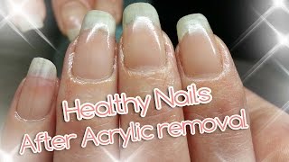 Acrylic Nail Removal  For Healthy Nails [upl. by Femmine]