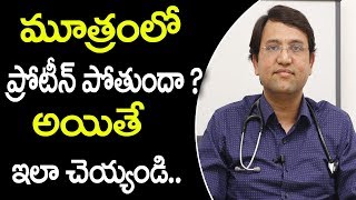 మూత్రంలో ప్రోటీన్ పోతే ఏంచేయాలి  Best Treatment for Proteinuria  Albuminuria  Latest Health tips [upl. by Eicnahc744]