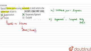 Special fibrous joint occuring exclusively in skull which is the tightest type of joint is [upl. by Kooima]