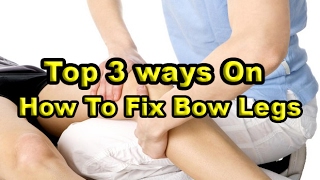 Top 3 ways On How To Fix Bow Legs [upl. by Armat]