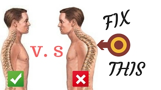 3 تمارين لعلاج تقوس الظهر الأتب kyphosis treatment [upl. by Ys]