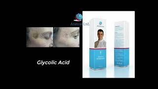 Seborrheic keratosis Removal using XanthRemover 70 Glycolic Acid Peel at home [upl. by Malony]