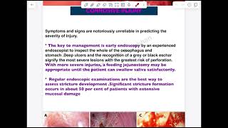 Esophagus Lec 2  First Part [upl. by Hutton]