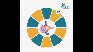 Recognizing the Signs Early Warning Signs of Pancreatic Cancer [upl. by Lashar]