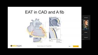 Pauley Heart Center Cardiology Grand Rounds  May 30 2024 [upl. by Yeh]