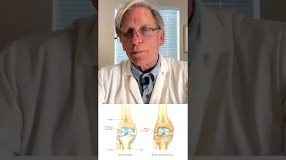 How Essential Oils Prevent Arthritis and Bone Spurs [upl. by Nyrret]