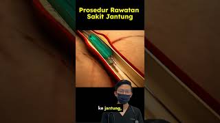 Prosedur Kateterisasi Jantung Dijelaskan [upl. by Cozmo]