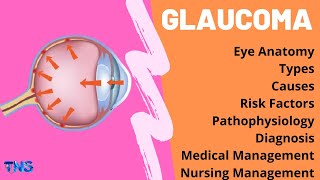 GLAUCOMA  Types  Pathophysiology  Nursing Management  Medical Management  The Nurses Station [upl. by Oettam]