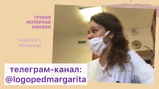 Инсульт Моторная афазия центр БрокаВосстановление речиBroca’s aphasia [upl. by Keen]