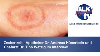 Zeckenzeit  Apotheker Dr Andreas Hünerbein und Chefarzt Dr Tino Wetzig im Interview [upl. by Suilienroc]