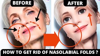 🛑 HOW TO GET RID OF NASOLABIAL FOLDS WITH FACE YOGA  JOWLS SAGGY SKIN FOREHEAD LINES FROWN LINES [upl. by Yenohtna]