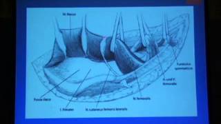 15 Ilioinguinal approach Rommens [upl. by Enirual]