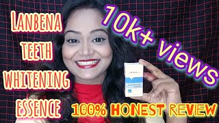 Lanbena teeth whitening essence review100 honest reviewdetails about Lanbena lanbena review [upl. by Nodnarb973]