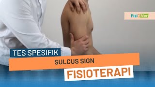 Sulcus Sign  Instability Pada Sendi Bahu Bagian Inferior [upl. by Anaiq]