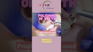 See the method of Polishing the teeth with prophy paste [upl. by Asiulana780]