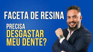 ENTENDA É preciso desgastar os dentes para aplicar as facetas de resina [upl. by Alyakem]