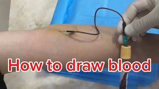 How to draw blood [upl. by Ailsun]