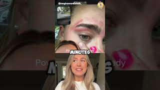 Eyebrow Waxing Fail Accutane Alert 🤯👀 [upl. by Jobyna]