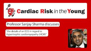 ECG 2 Hypertrophic cardiomyopathy HCM [upl. by Etnor]