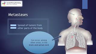 Briefly explained Metastases [upl. by Letch809]