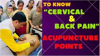 TO KNOW quotCERVICAL amp BACK PAINquot ACUPUNCTURE POINTS [upl. by Yelram]