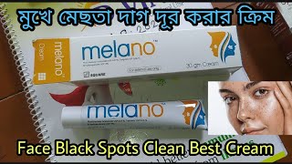 Melano Cream এর কাজ কি দাম কত ব্যবহার করার নিয়মবিস্তিরিত ভিডিও তে । [upl. by Naeerb217]