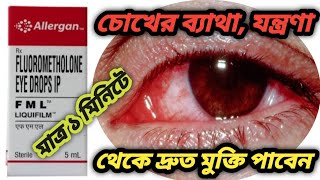 FML eye drops benefits use in bengali review How to benefits in FML eye drops [upl. by Svensen438]