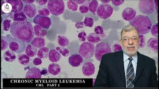 Chronic Myeloid Leukemia Part 2 [upl. by Yerrok]