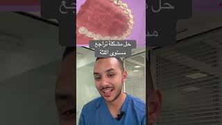 حل مشكلة تراجع مستوى اللثة بعملية زراعة اللثة viralvideo dentistry dentist dentistetanger [upl. by Threlkeld]