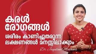 Liver disease  Early signs  കരൾ രോഗങ്ങൾ  ശരീരം കാണിക്കുന്ന ആദ്യ ലക്ഷണങ്ങൾ  Dr Jaquline Mathews [upl. by Buonomo]