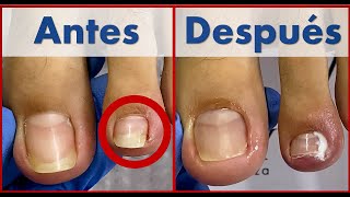 pedicura profunda  que uso para desinfectar y cicatrizar trabajo en cliente  Extreme pedicure [upl. by Adrien385]