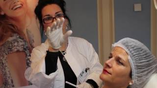 Filler Behandlungen mit Restylane [upl. by Zweig591]