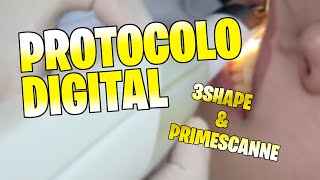 PrimeScanne vs Trios 3  Scanner Intraoral [upl. by Deste]