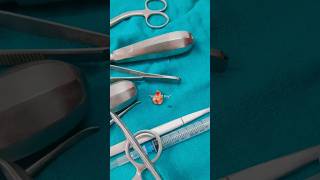 mesioangular impaction extraction minor OT Day Posting days Oral surgery  OMFS internships [upl. by Naedan]