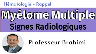 Myélome Multiple Signes Radiologiques [upl. by Nodyarg404]