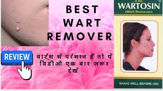 Wartosin cream review  best wart removal cream  wartosin review in hindi [upl. by Neelie]