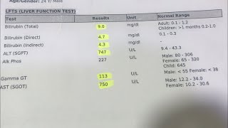 Liver function test result in Urduhindi  LFT Test Result  main test for liver [upl. by Notniuqal]