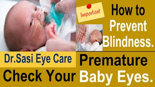 Prevent Blindness  Premature Babies  Check your Baby Eyes Immediately  DrSasi [upl. by Kiah]