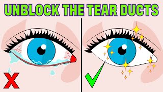 How to Fix a Blocked Tear Duct WITHOUT having Surgery [upl. by Annetta]