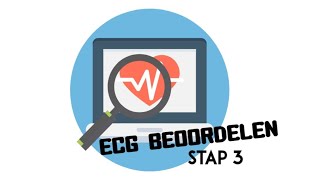 ECG Beoordelen  stap 3 Hartas [upl. by Jocko]