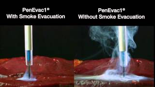 IC Medicals PenEvac1 Surgical Smoke Evacuation [upl. by Nazar]