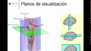 Anatomía básica del Sistema Nervioso1 Cortes y planos anatómicos [upl. by Aney302]