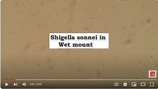 Shigella sonnei in Wet mount Microscopy [upl. by Fachan769]