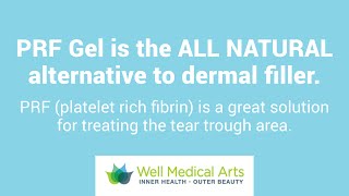 PRF gel is the all natural dermal filler available at Well Medical Arts in Seattle [upl. by Attah]