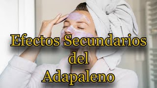 Efectos Secundarios del Adapaleno [upl. by Nosemyaj895]