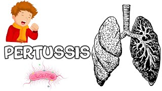 Pertussis Whooping Cough  Causes Signs amp Symptoms Complications Diagnosis And Treatment [upl. by Ecyt732]