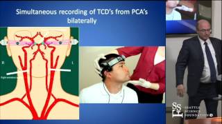 Head Turn Syncope Rotational Vertebrobasilar Ischemia by David Newell MD [upl. by Yanaj148]